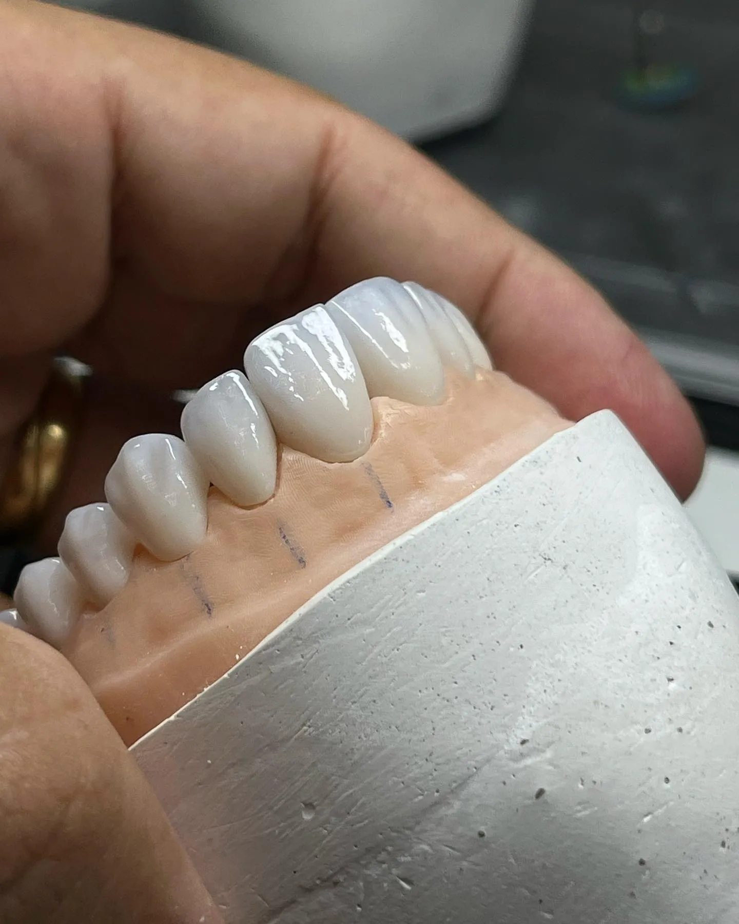 Peça cerâmica E.Max em acabamento